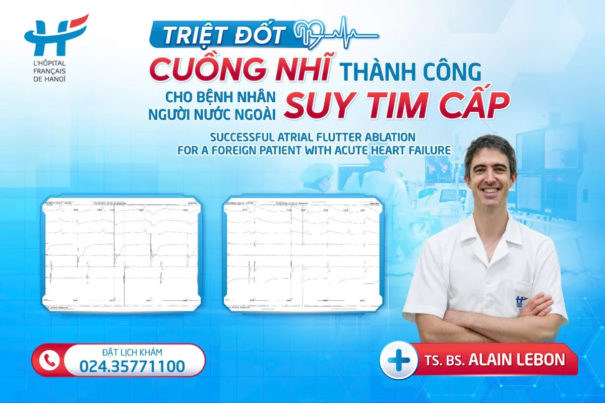 TRIỆT ĐỐT CUỒNG NHĨ THÀNH CÔNG CHO BỆNH NHÂN NƯỚC NGOÀI SUY TIM CẤP